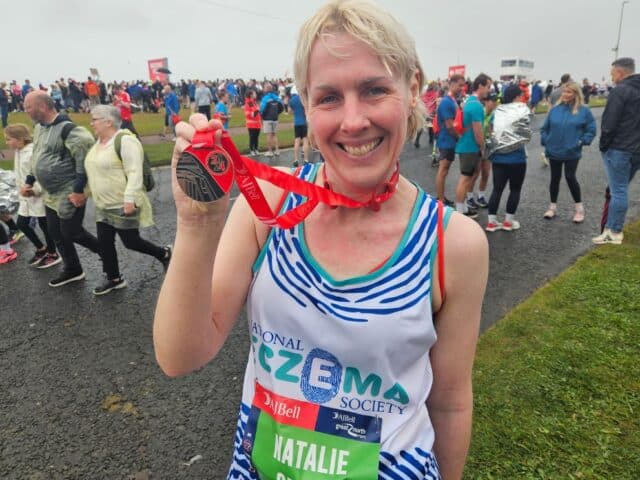 A white women, with visible eczema on her face, is wearing a National Eczema Society running vest. They are holding a Great North Run 2024 finisher medal.